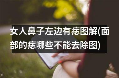 <h3>女人鼻子左边有痣图解(面部的痣哪些不能去除图)