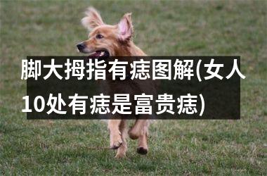 脚大拇指有痣图解(女人10处有痣是富贵痣)