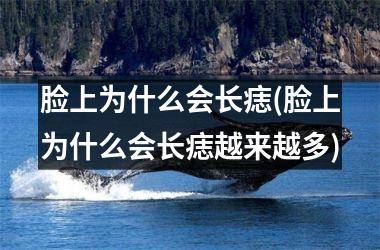 <h3>脸上为什么会长痣(脸上为什么会长痣越来越多)