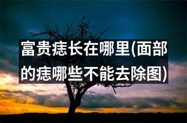 富贵痣长在哪里(面部的痣哪些不能去除图)