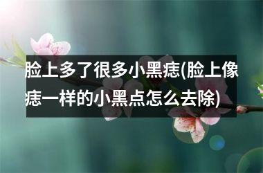 脸上多了很多小黑痣(脸上像痣一样的小黑点怎么去除)