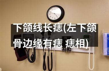 <h3>下颌线长痣(左下颌骨边缘有痣 痣相)