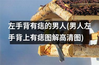 <h3>左手背有痣的男人(男人左手背上有痣图解高清图)