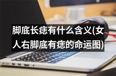 <h3>脚底长痣有什么含义(女人右脚底有痣的命运图)