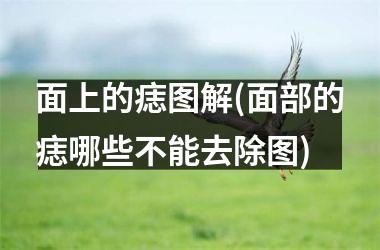 面上的痣图解(面部的痣哪些不能去除图)
