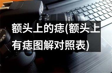 额头上的痣(额头上有痣图解对照表)