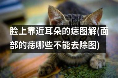 脸上靠近耳朵的痣图解(面部的痣哪些不能去除图)