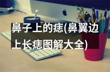 <h3>鼻子上的痣(鼻翼边上长痣图解大全)