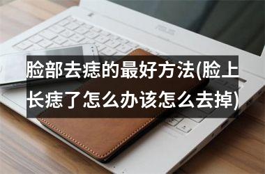 脸部去痣的最好方法(脸上长痣了怎么办该怎么去掉)