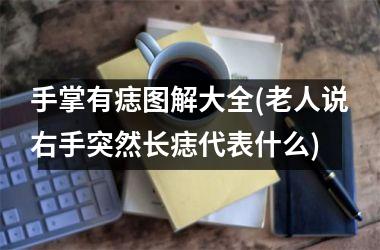 <h3>手掌有痣图解大全(老人说右手突然长痣代表什么)