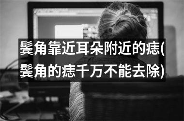 鬓角靠近耳朵附近的痣(鬓角的痣千万不能去除)
