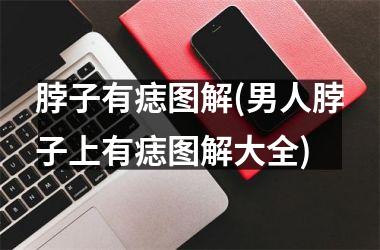 <h3>脖子有痣图解(男人脖子上有痣图解大全)