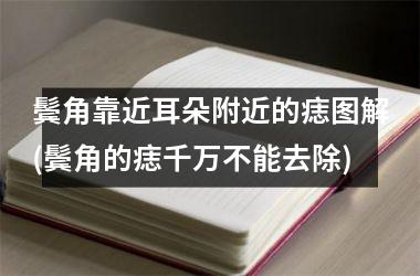 <h3>鬓角靠近耳朵附近的痣图解(鬓角的痣千万不能去除)