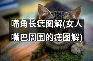 嘴角长痣图解(女人嘴巴周围的痣图解)