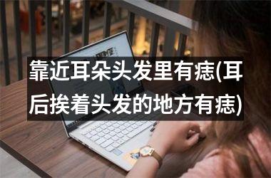 靠近耳朵头发里有痣(耳后挨着头发的地方有痣)