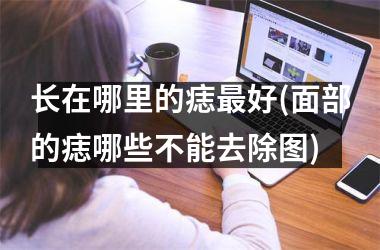 <h3>长在哪里的痣最好(面部的痣哪些不能去除图)