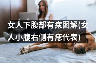 <h3>女人下腹部有痣图解(女人小腹右侧有痣代表)