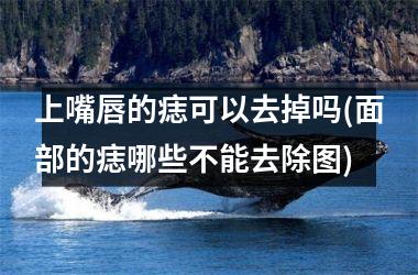 <h3>上嘴唇的痣可以去掉吗(面部的痣哪些不能去除图)