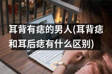 耳背有痣的男人(耳背痣和耳后痣有什么区别)