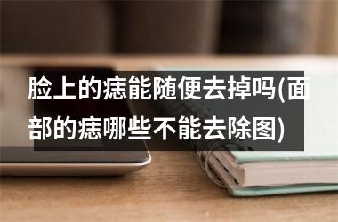 脸上的痣能随便去掉吗(面部的痣哪些不能去除图)