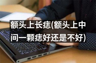 额头上长痣(额头上中间一颗痣好还是不好)