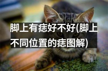 <h3>脚上有痣好不好(脚上不同位置的痣图解)