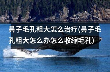 鼻子毛孔粗大怎么治疗(鼻子毛孔粗大怎么办怎么收缩毛孔)
