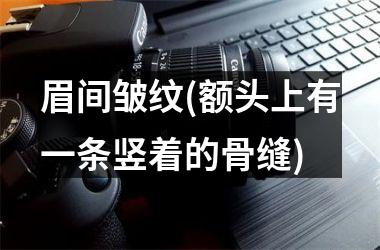 <h3>眉间皱纹(额头上有一条竖着的骨缝)