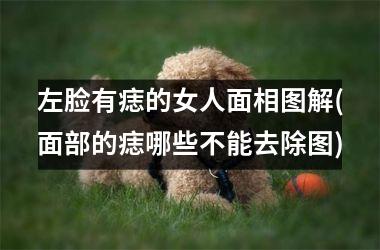 <h3>左脸有痣的女人面相图解(面部的痣哪些不能去除图)