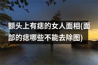 额头上有痣的女人面相(面部的痣哪些不能去除图)