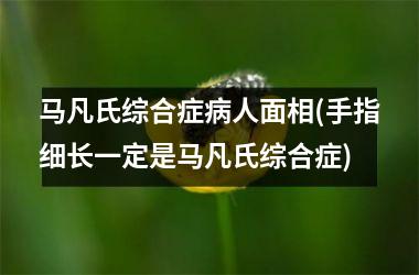 <h3>马凡氏综合症病人面相(手指细长一定是马凡氏综合症)