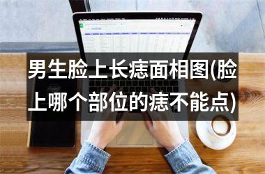 男生脸上长痣面相图(脸上哪个部位的痣不能点)