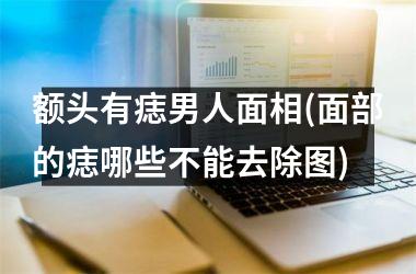 额头有痣男人面相(面部的痣哪些不能去除图)