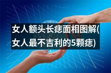 女人额头长痣面相图解(女人最不吉利的5颗痣)