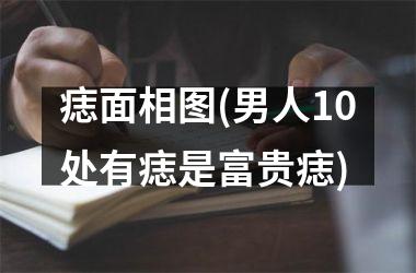 <h3>痣面相图(男人10处有痣是富贵痣)