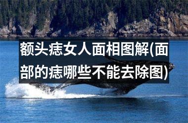 额头痣女人面相图解(面部的痣哪些不能去除图)